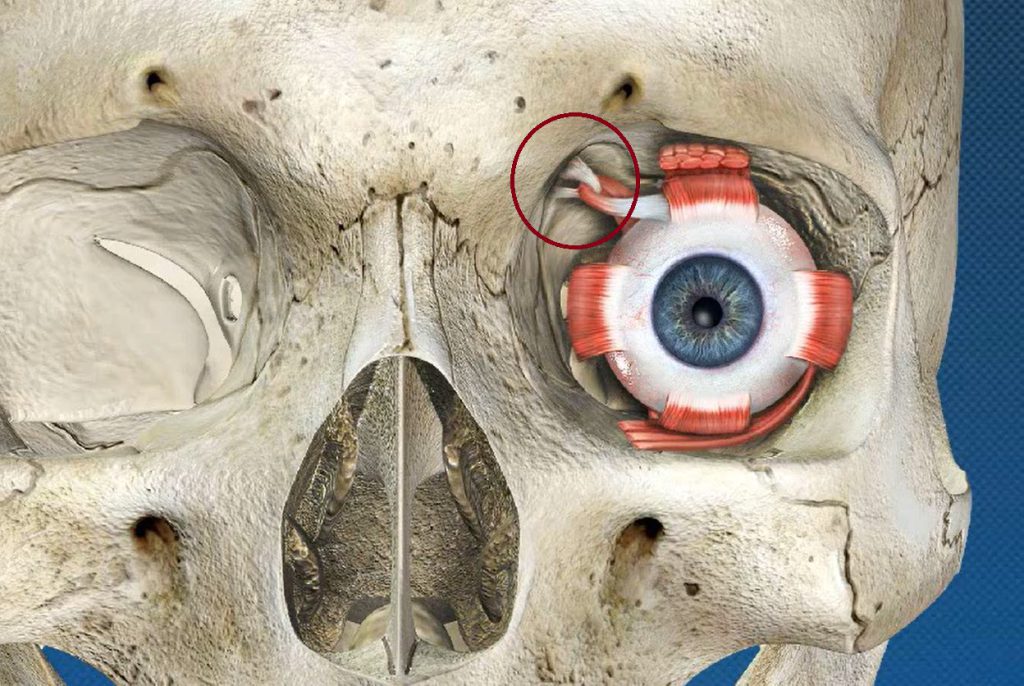 البكرة الغضروفية التي يتحرك من خلالها وتر العضلة المائلة العلوية